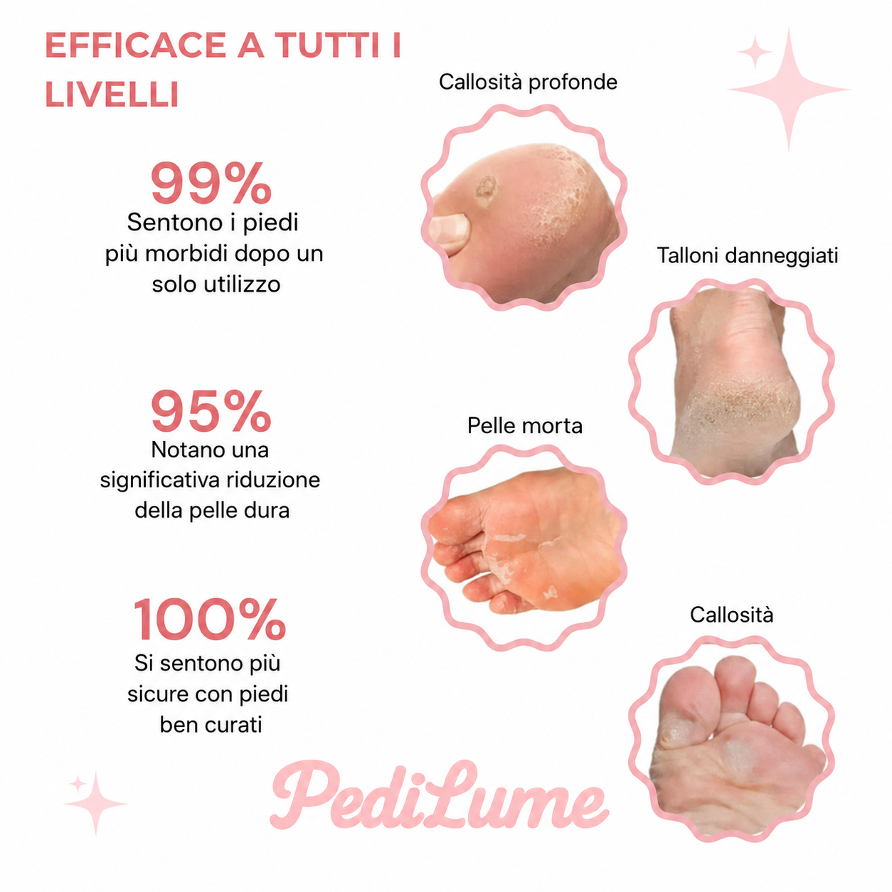 Pedilume™ – Kit Bellezza Piedi