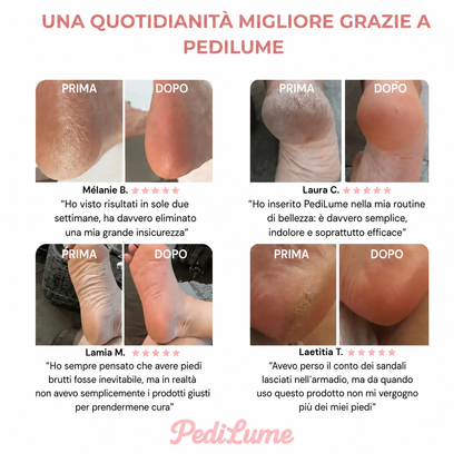 Pedilume™ – Kit Bellezza Piedi