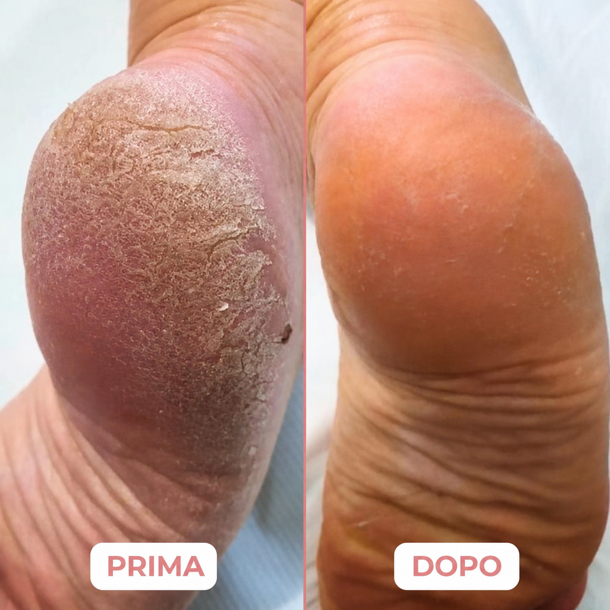 🍯 Pedilume Balm™ – Balsamo Idratante al Miele per i Piedi