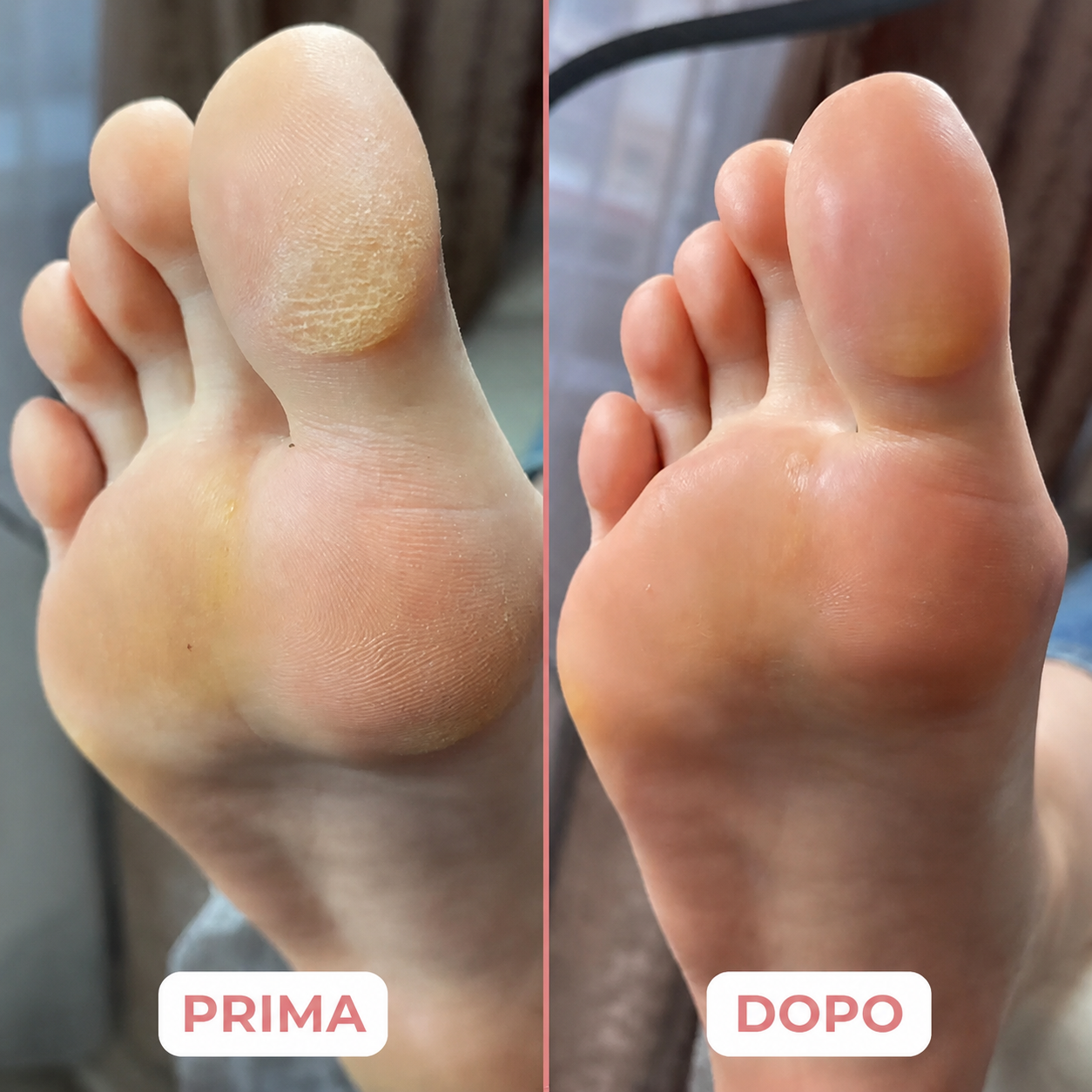 🍯 Pedilume Balm™ – Balsamo Idratante al Miele per i Piedi